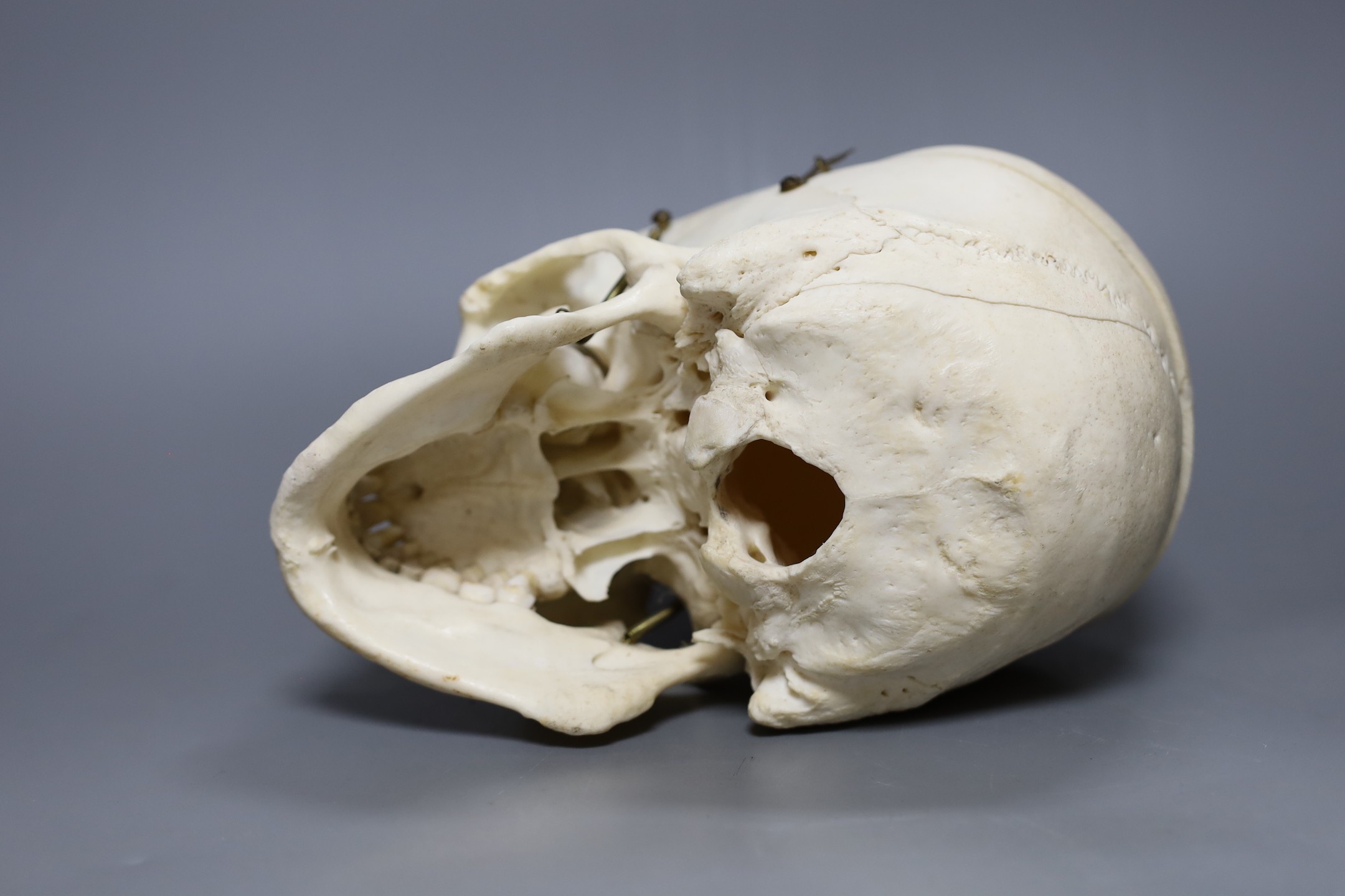 A human skull, 21 cms wide